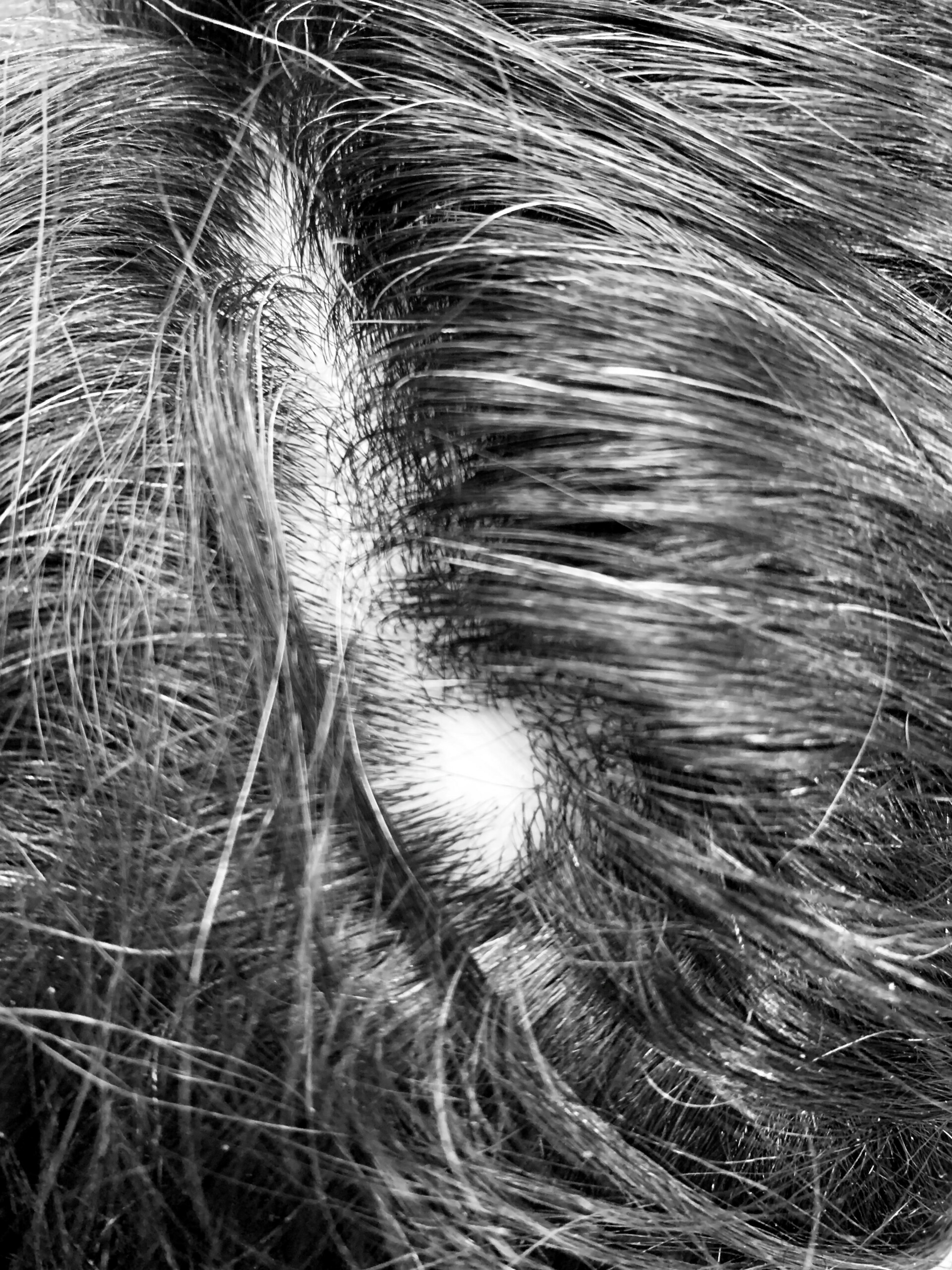 Scalp Micropigmentation for Women